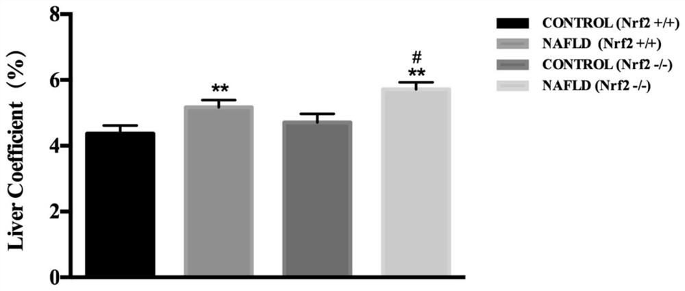 Application of ellagic acid to preparation of medicine for preventing and/or treating nonalcoholic fatty liver disease and liver injury