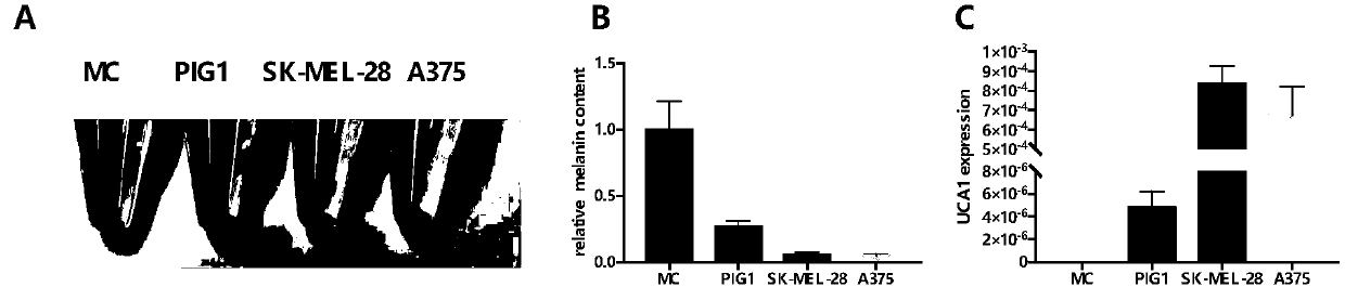 Application of UCA1 as target site to preparation of drugs for treating hyperpigmentation dermatoses