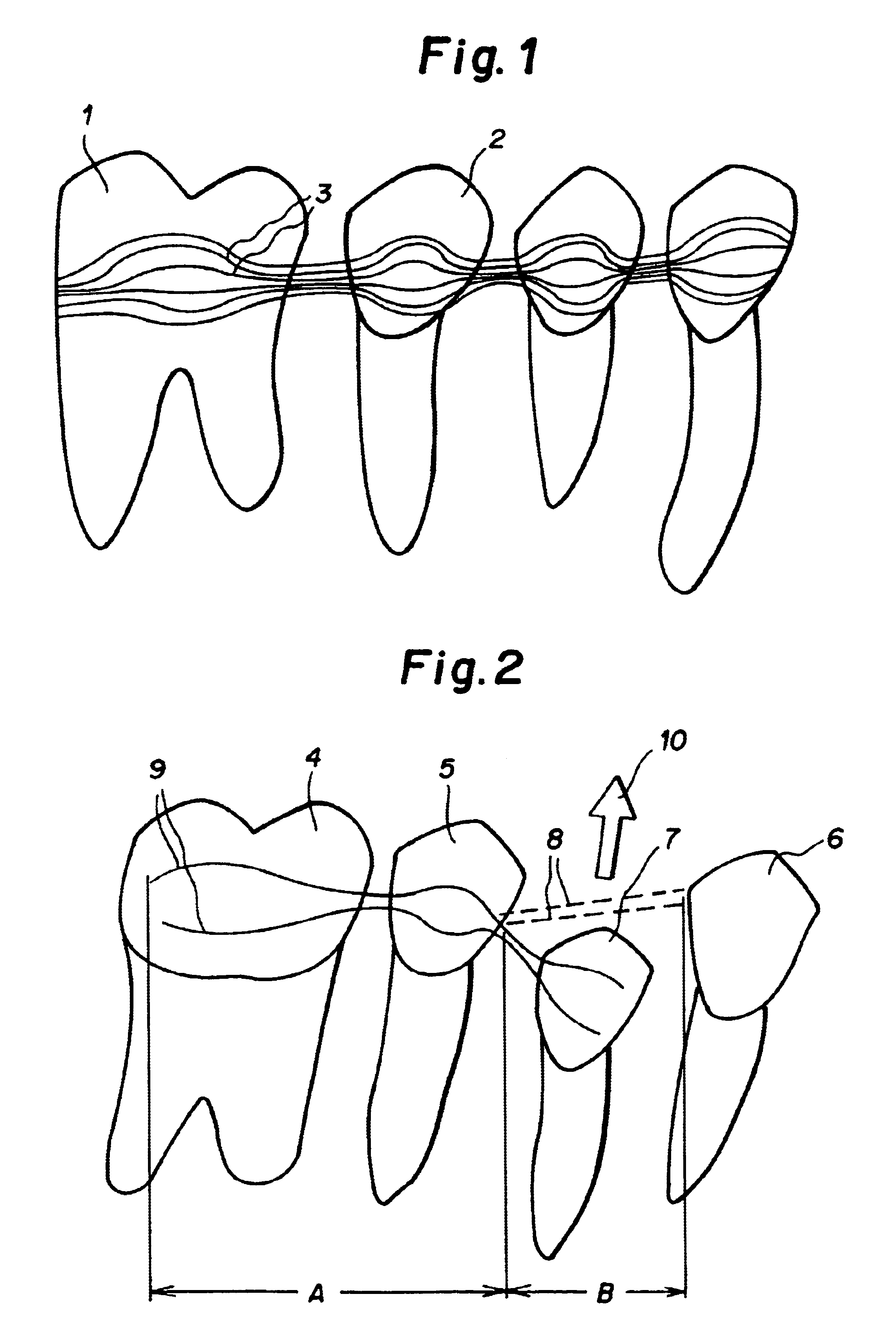 Orthodontic appliance