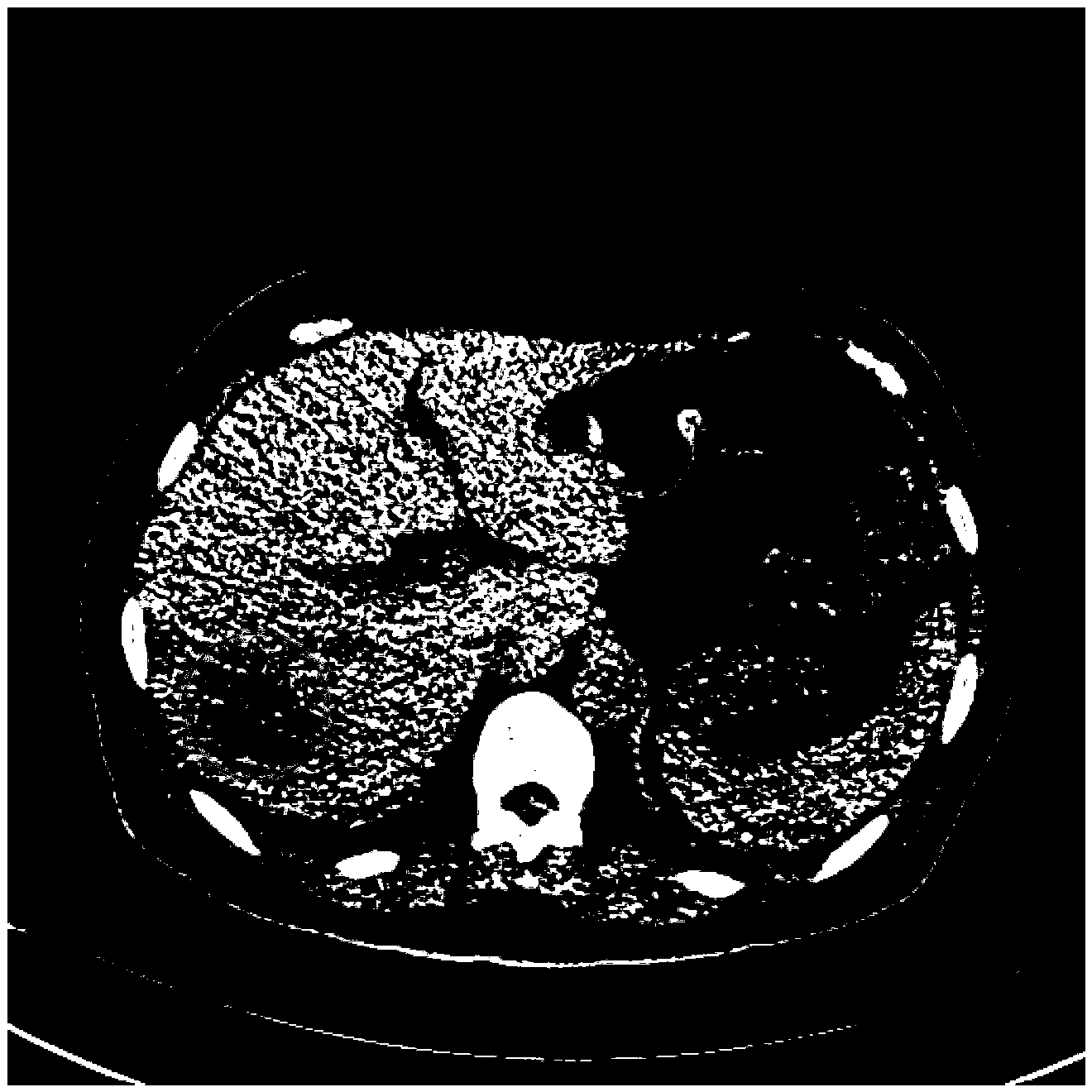 Low dose CT image filtering method