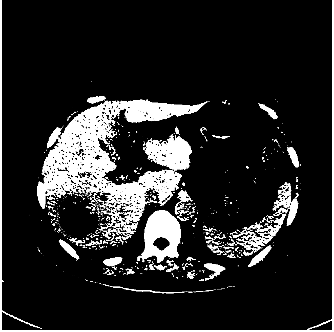 Low dose CT image filtering method