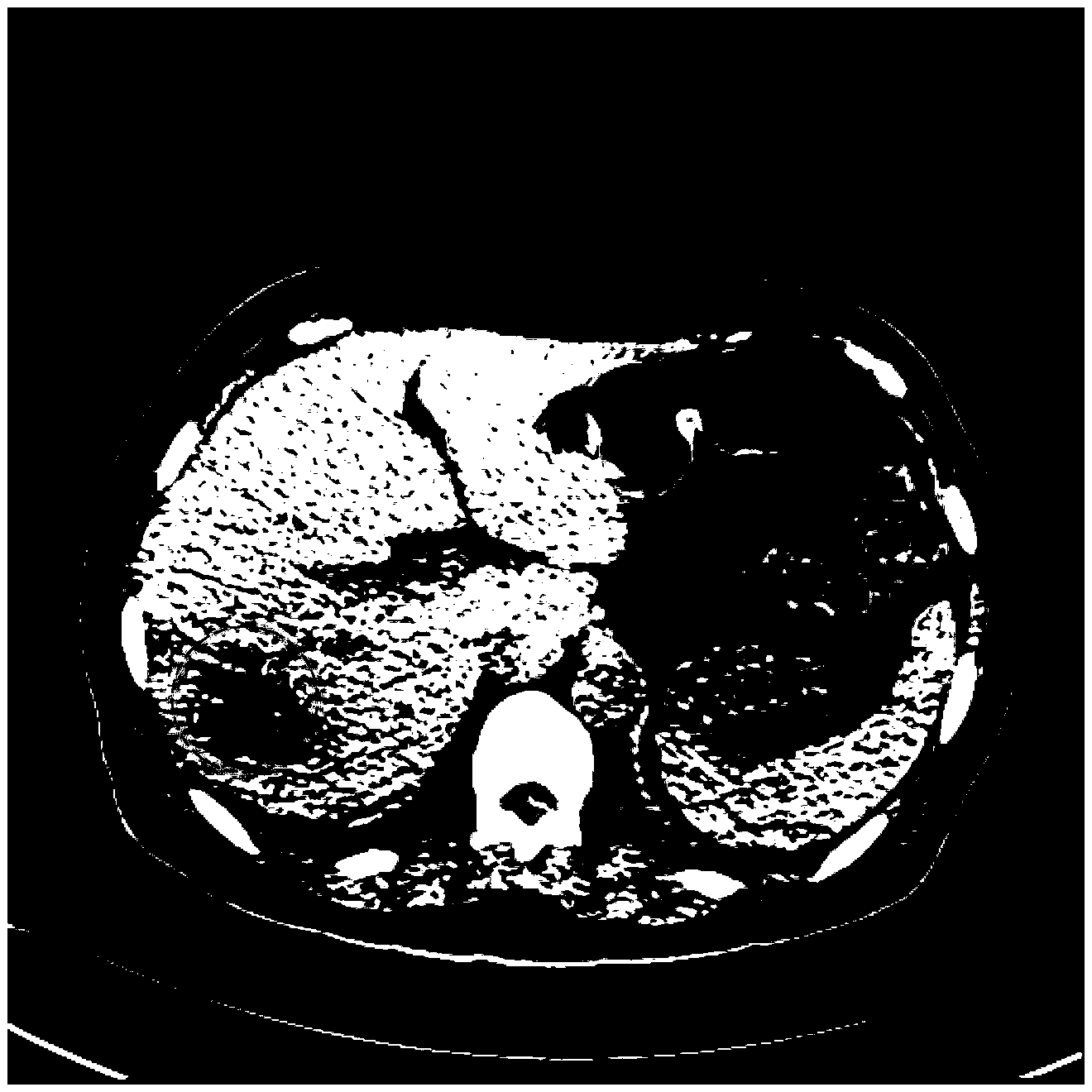 Low dose CT image filtering method