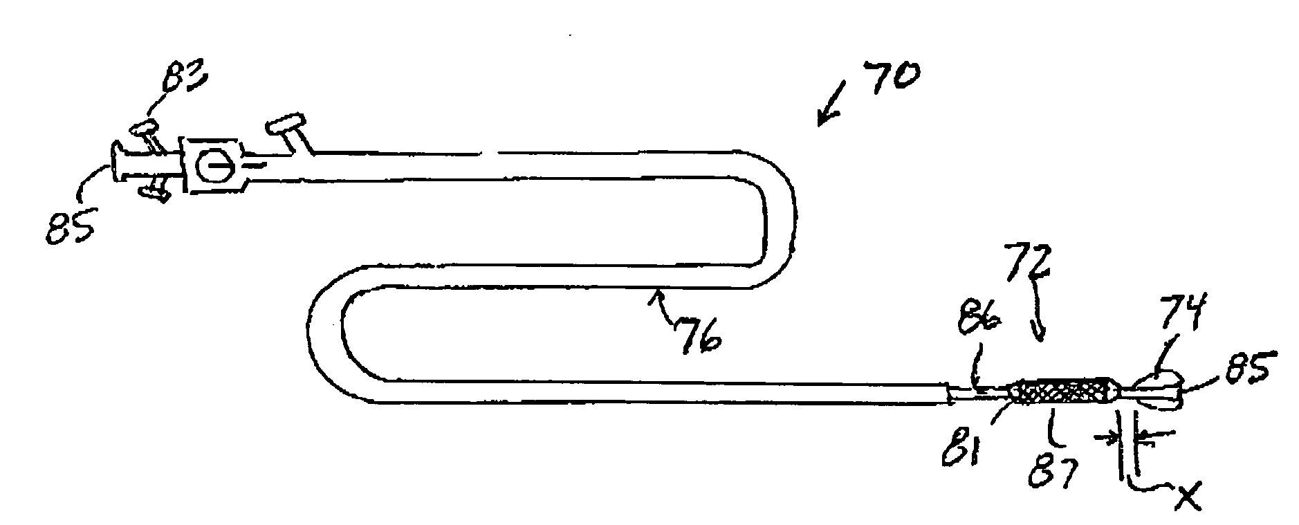 Apparatus and methods for renal stenting