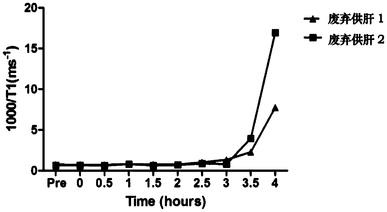 In-vitro liver function detection method and system