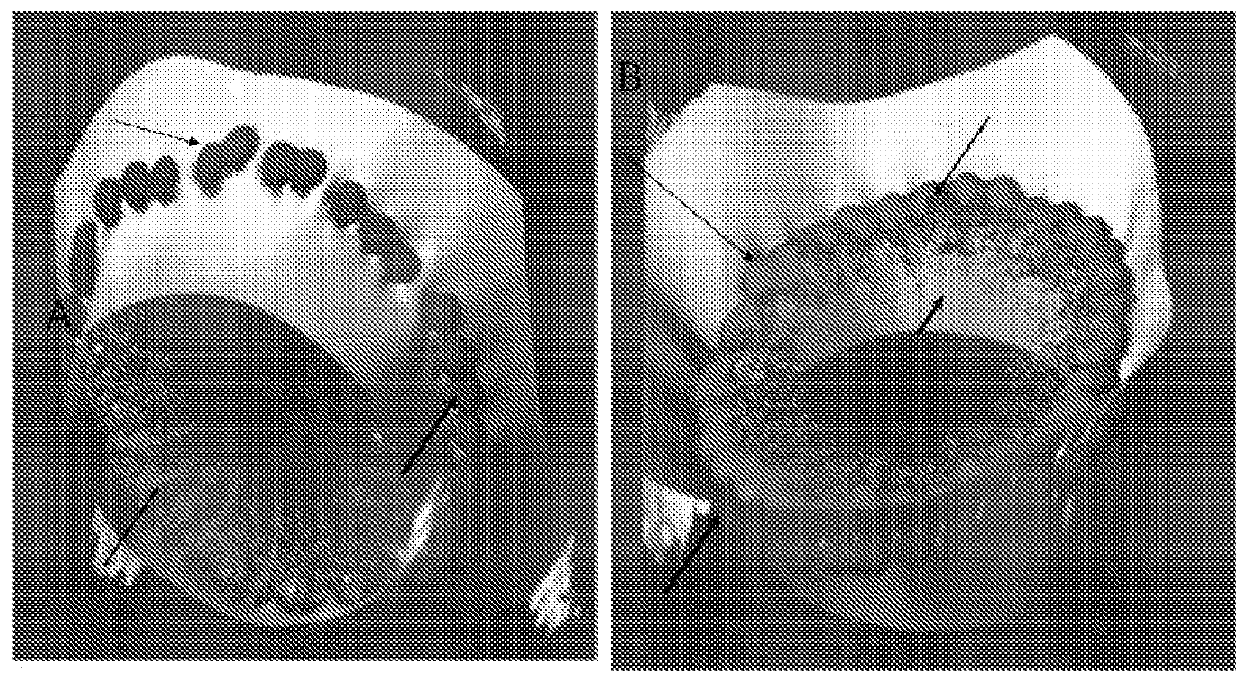 Cholestosome vesicles for incorporation of molecules into chylomicrons