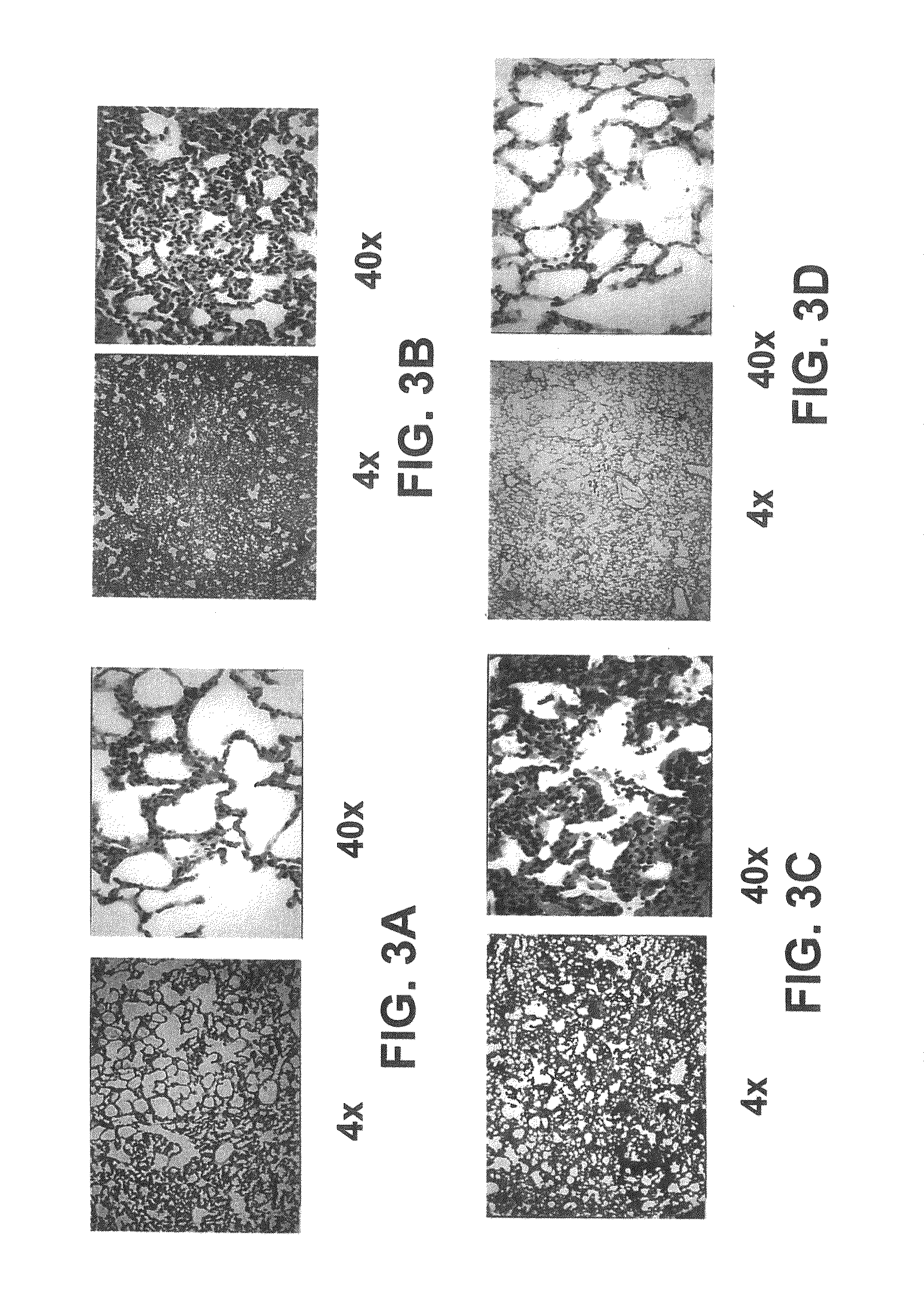 Albumin-based colloid composition and method of use in treating hypovolemia and multiorgan dysfunction