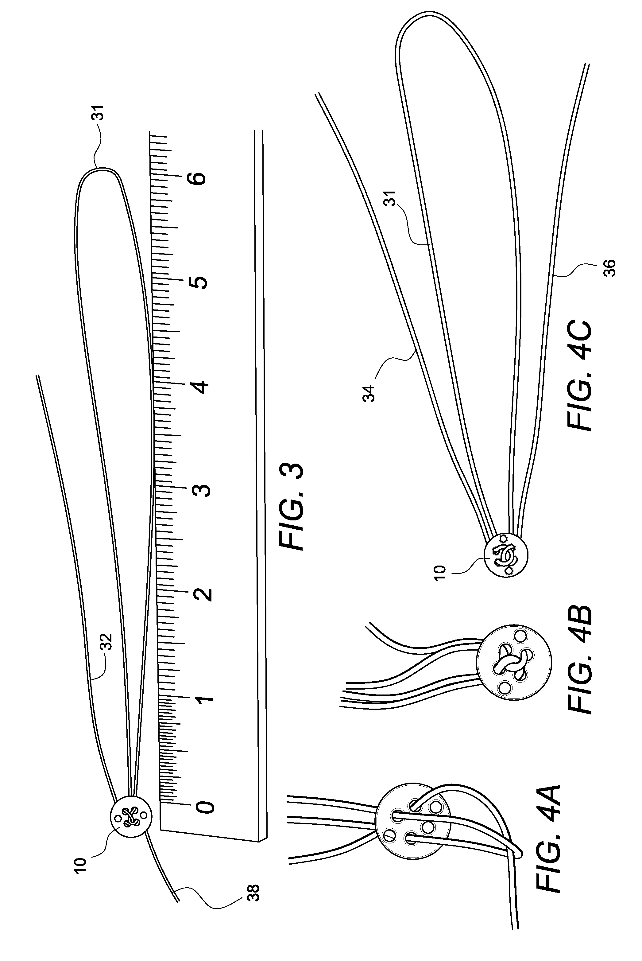 Adjustable suture-button constructs for ligament reconstruction