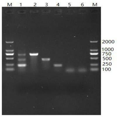 Multiplex PCR diagnosis kit for three pathogenic bacteria in milk