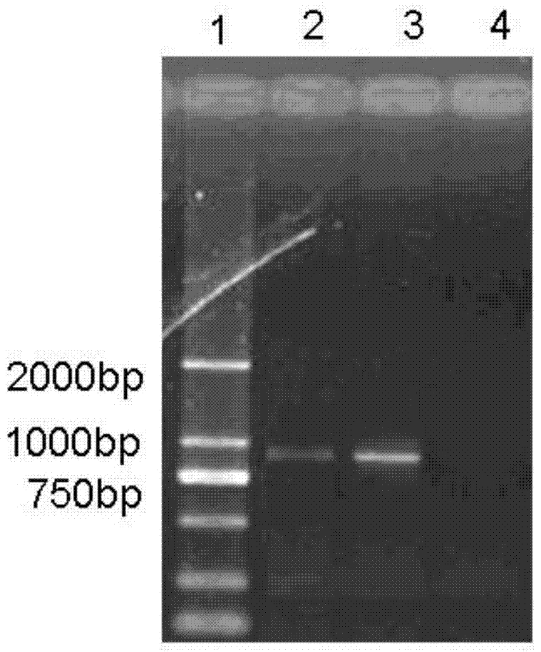 Novel mycoplasma hyopneumoniae strain and its vaccine composition