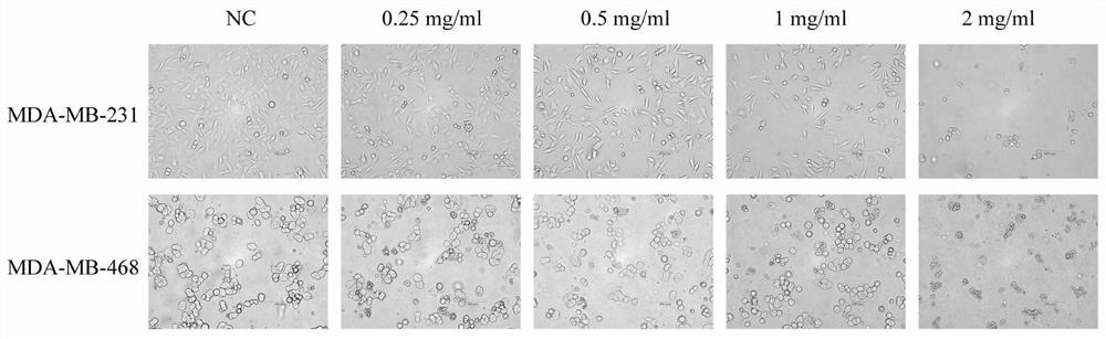 Application of Jinfei capsule in preparation of anti-breast cancer drugs