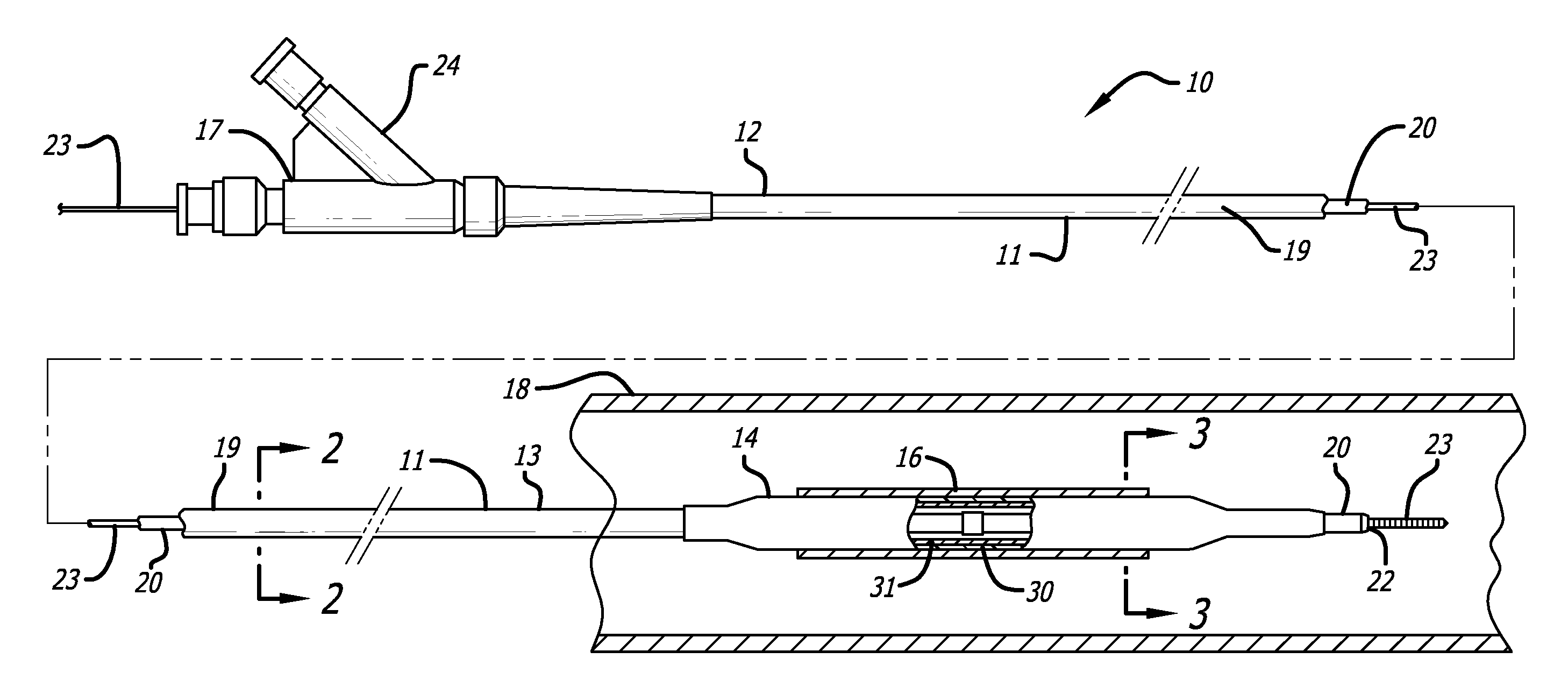 Catheter balloon and method for forming same