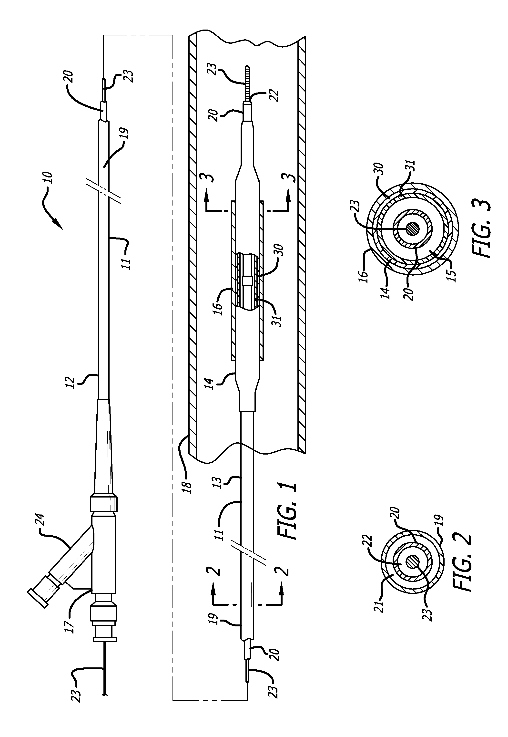 Catheter balloon and method for forming same