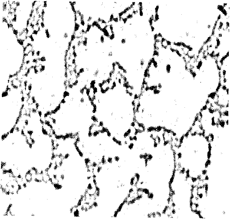 Biological deferrization demanganization functional bacterium