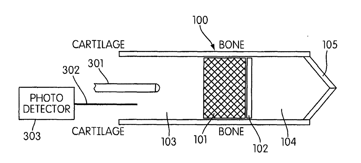 Earpiece and method for forming an earpiece