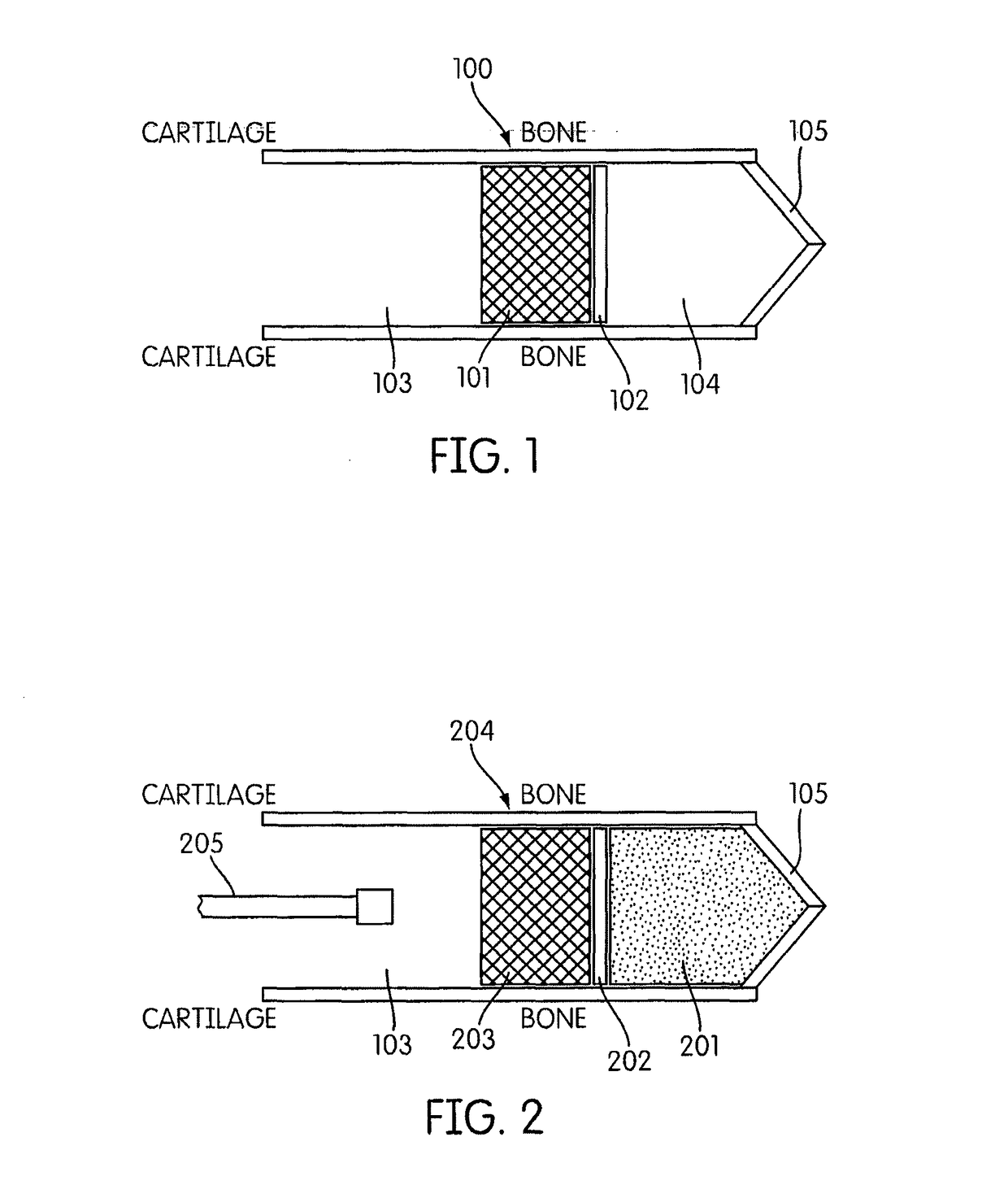 Earpiece and method for forming an earpiece