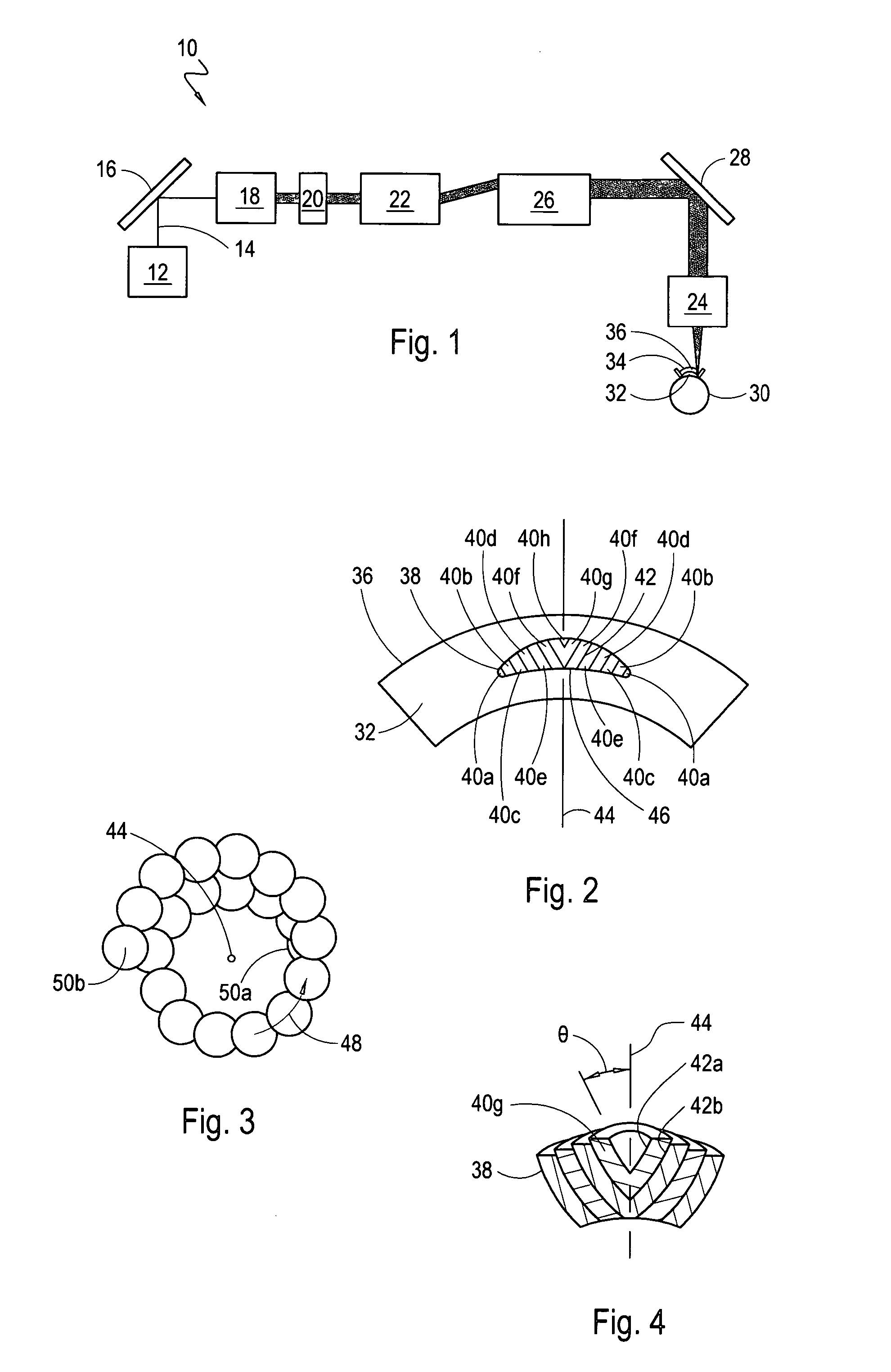 Systems and methods for intrastromal scanning patterns