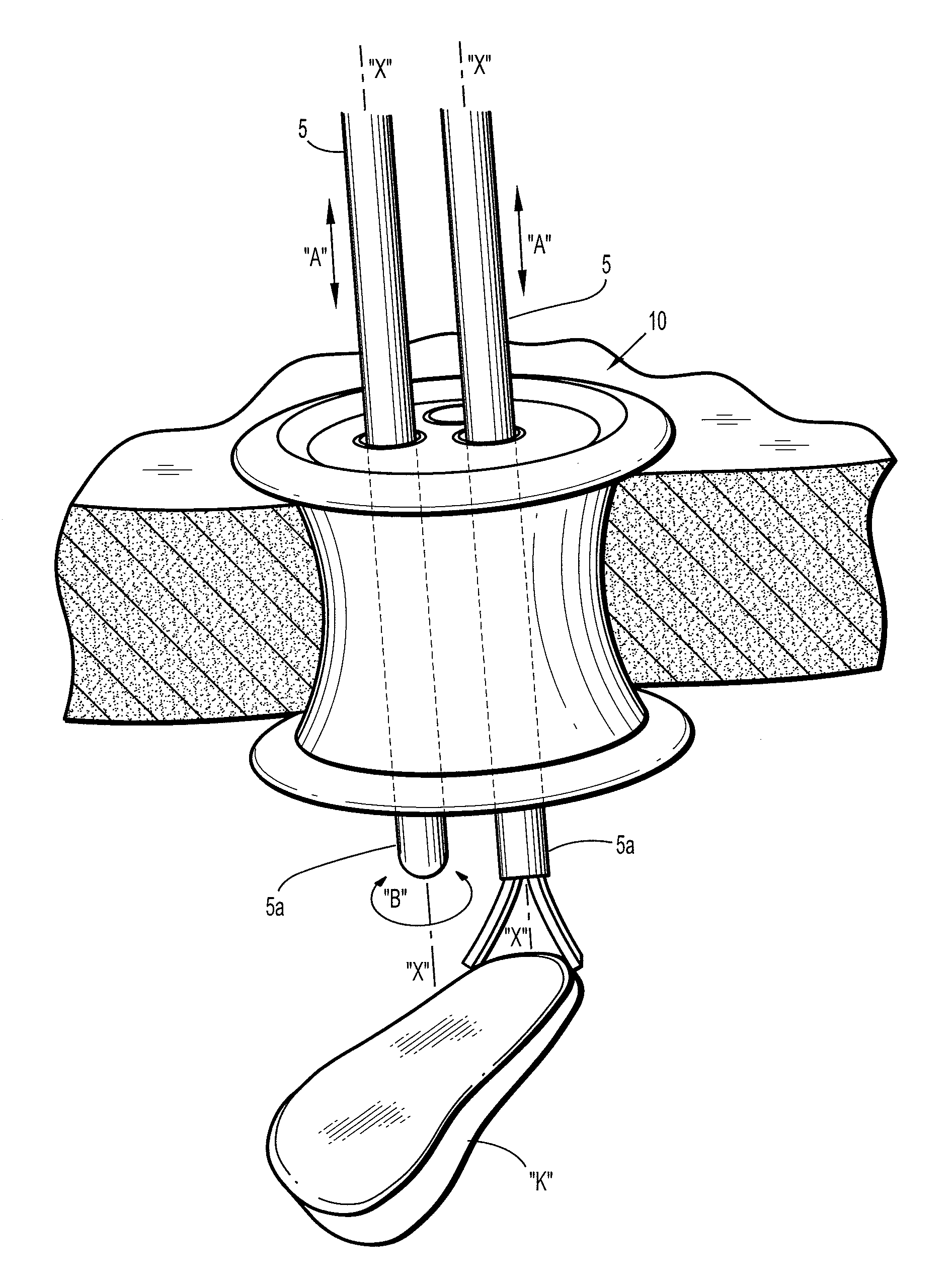 Flexible access assembly with multiple ports