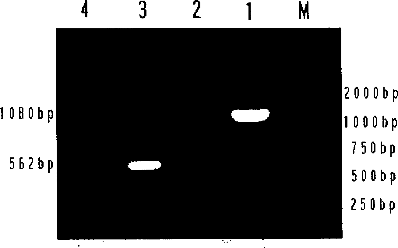 Mandarin fish infectious splenorenal necrosis virogene diagnostic kit and detecting method thereof