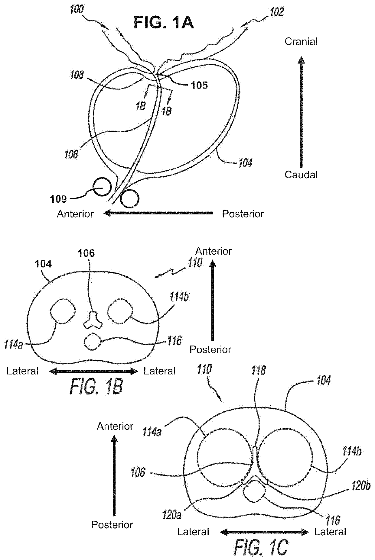 Dilating device and method for prostatic urethra