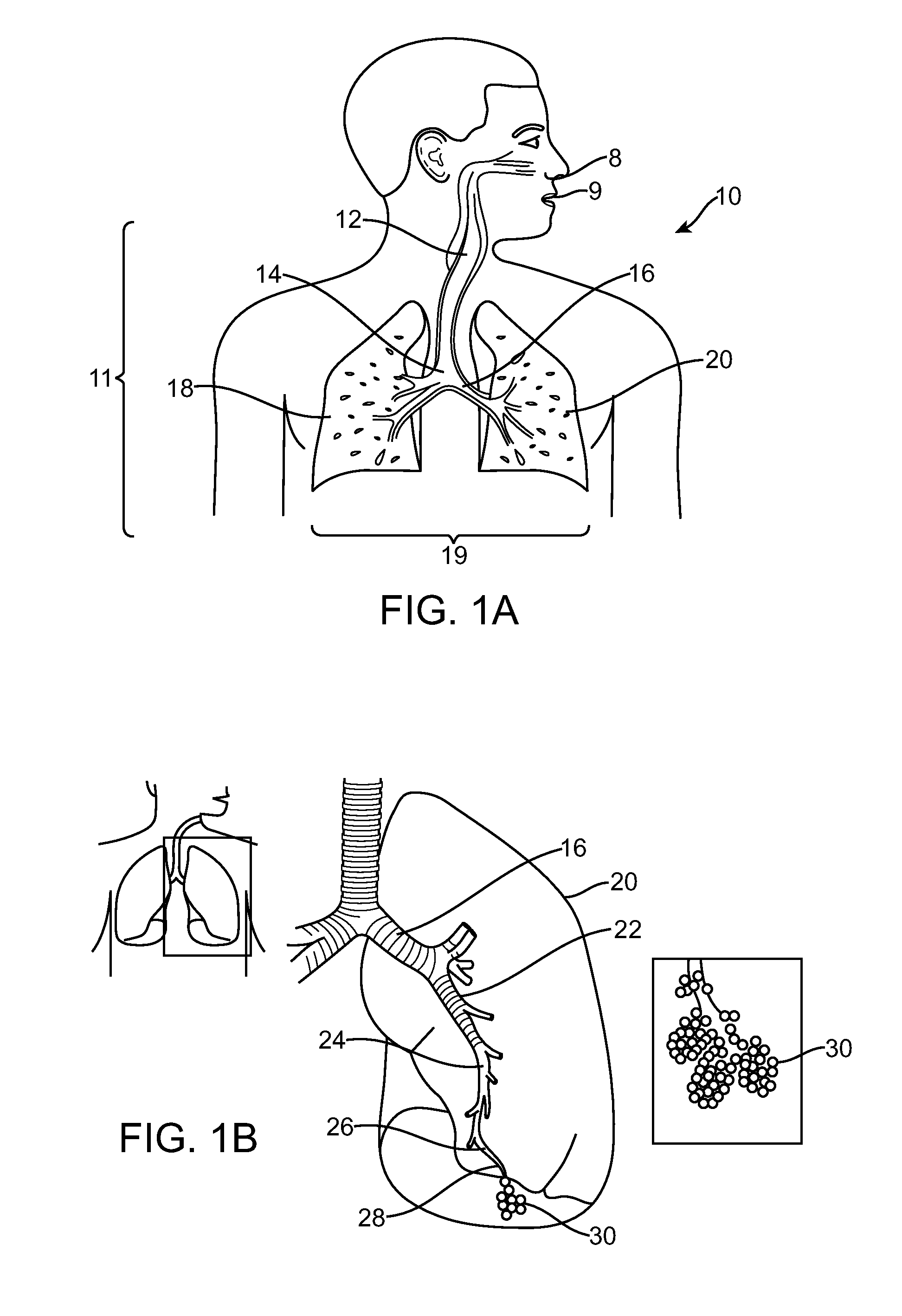 Lung Volume Reduction Devices, Methods, and Systems