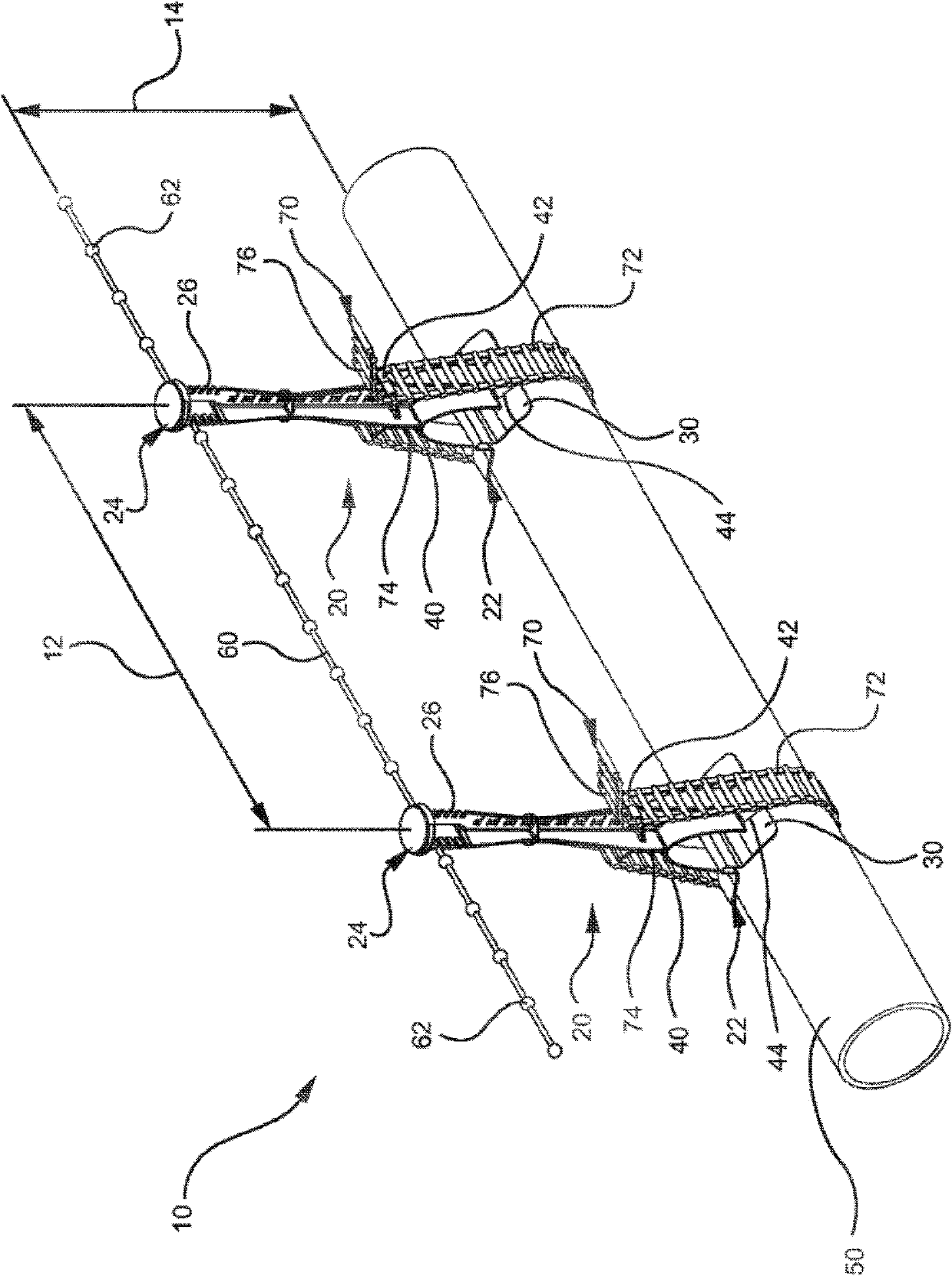 Systems and methods for marking and detecting an underground utility