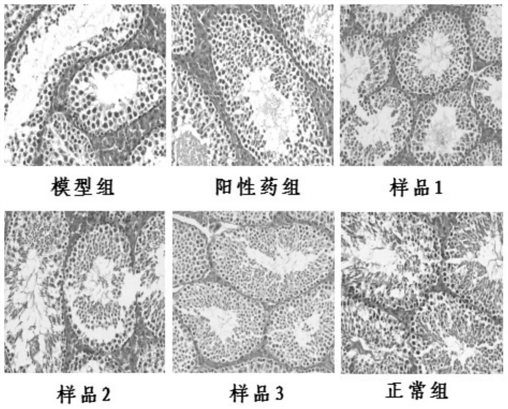 Ginseng glycoprotein and its preparation method and application