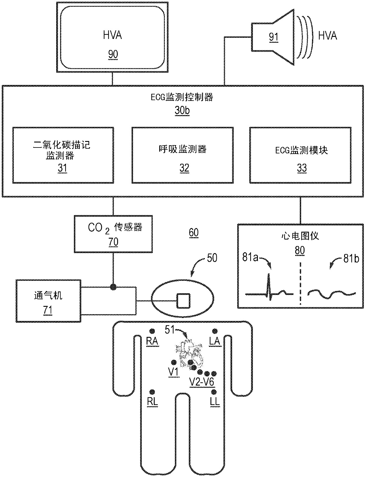 Monitoring device with multi-parameter hyperventilation alert