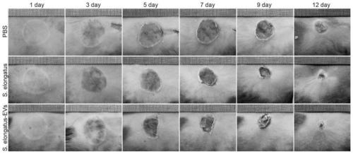 Application of cyanobacteria and their outer membrane vesicles in the preparation of drugs for treating diseases