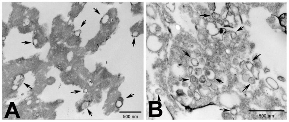 Method for rapidly increasing exosome yield of adipose tissue-derived stromal cells