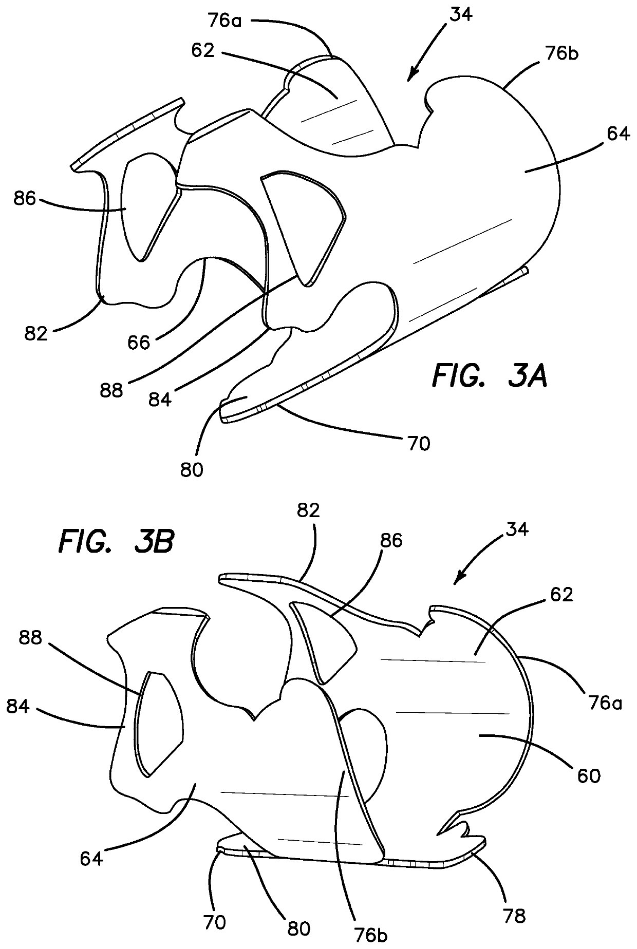 Hysterectomy model