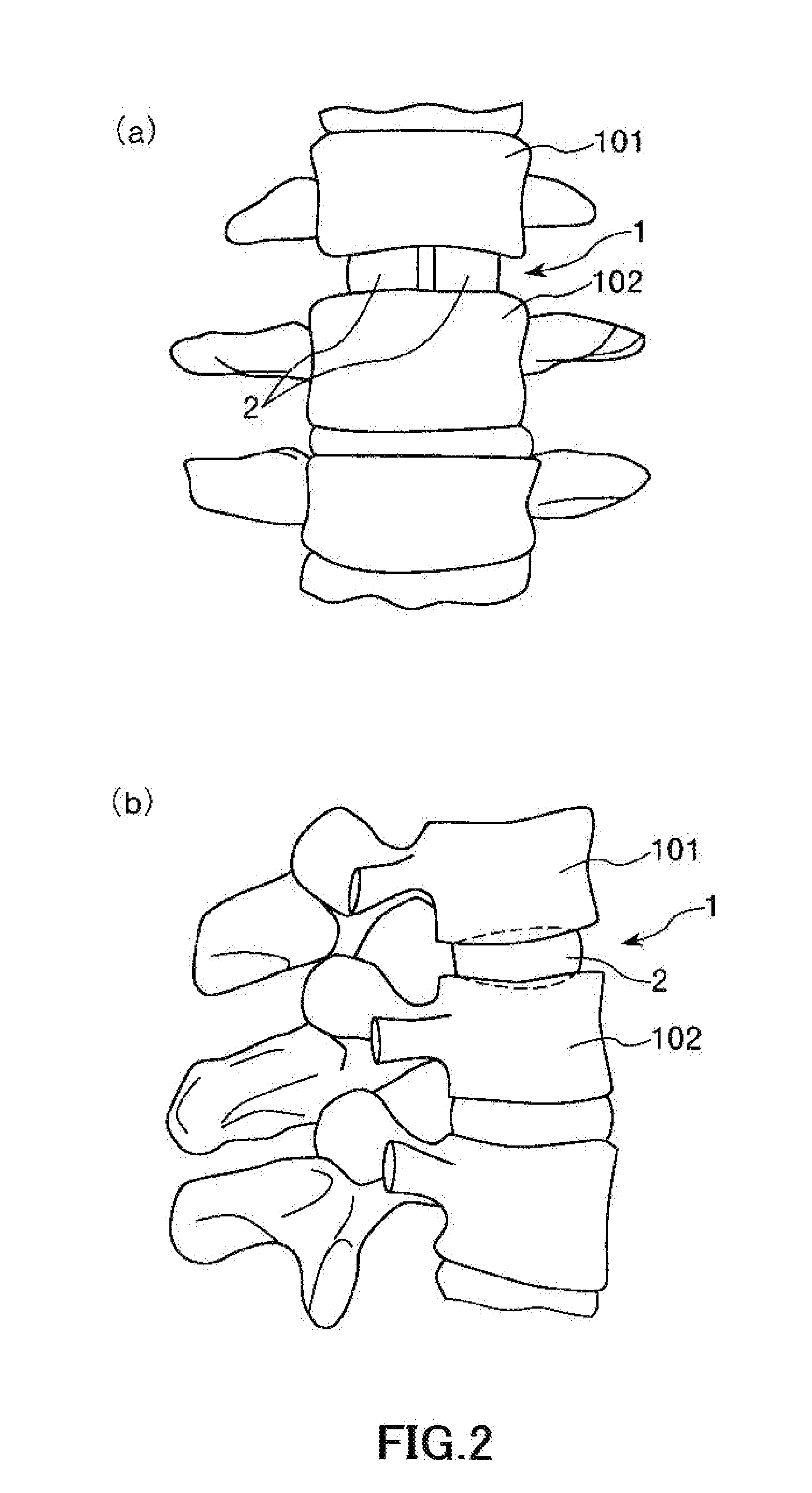 Vertebral body spacer