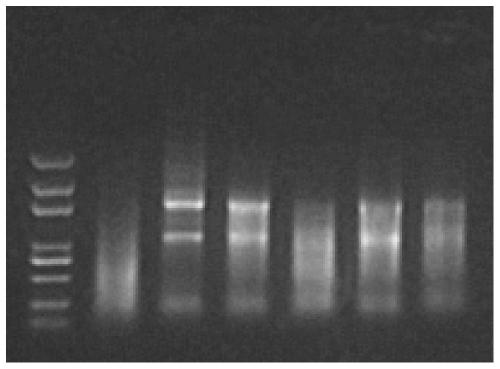 Virus sample preserving fluid for viral nucleic acid clinical detection and use method thereof