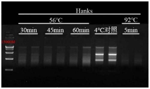 Virus sample preserving fluid for viral nucleic acid clinical detection and use method thereof