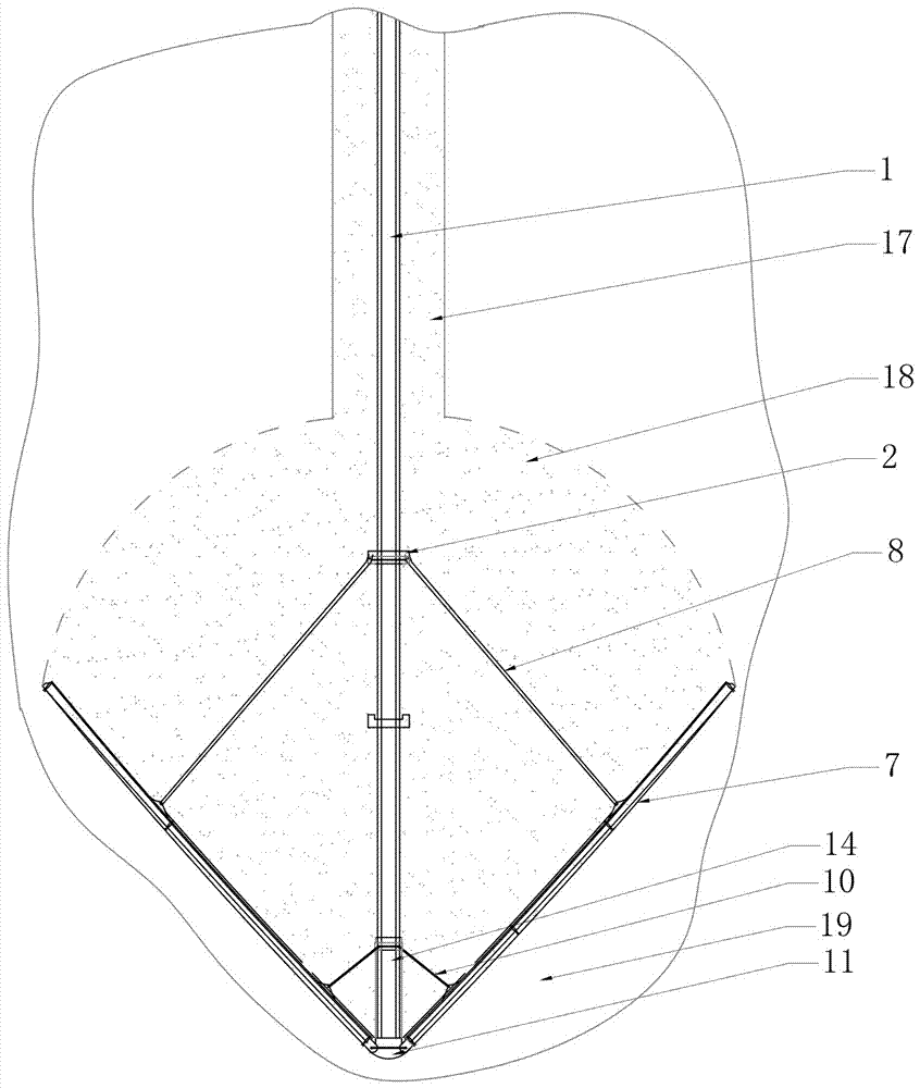 Anchor stock structure with expanded head