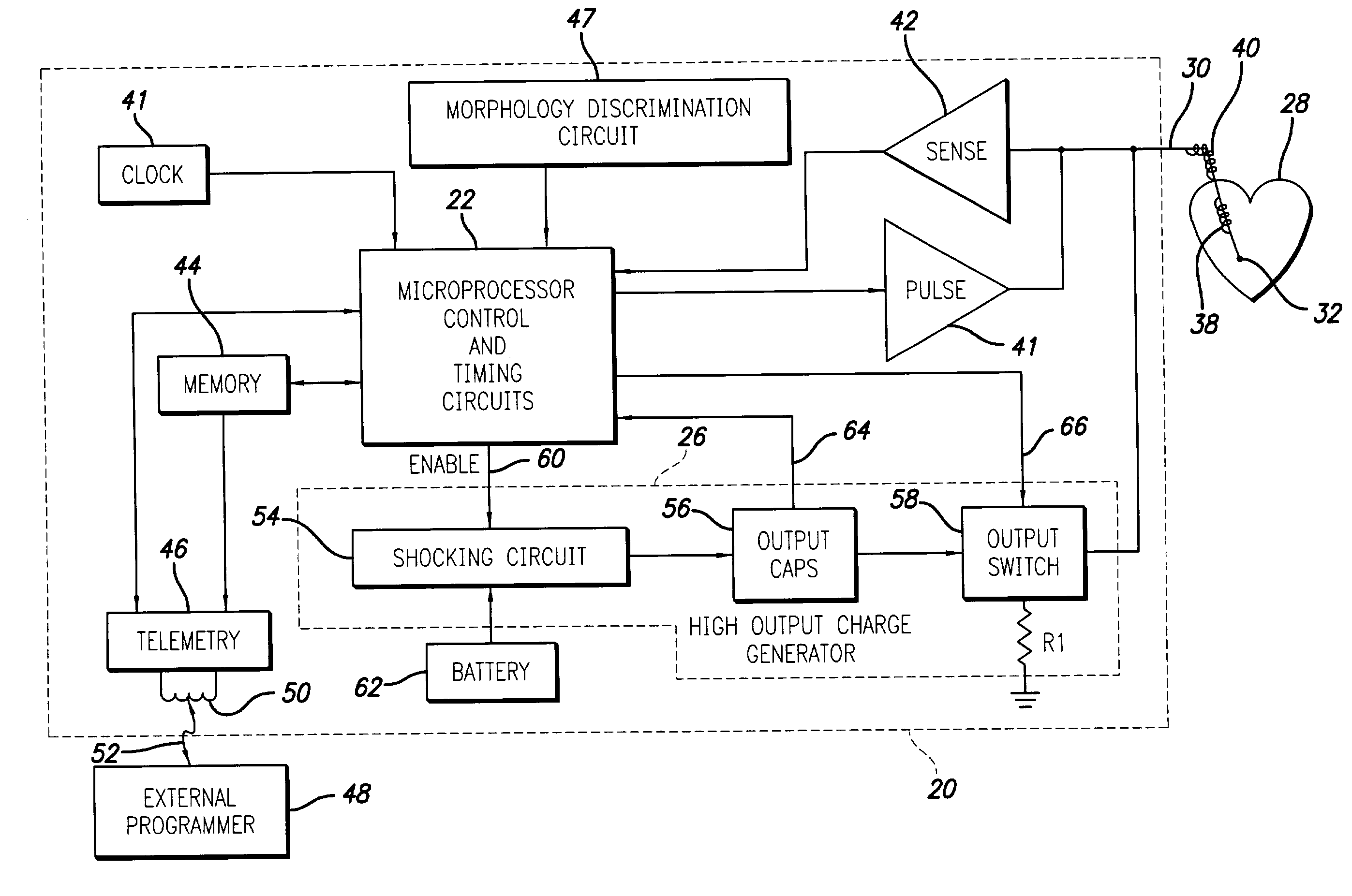 Implantable cardioversion device with a self-adjusting threshold for therapy selection