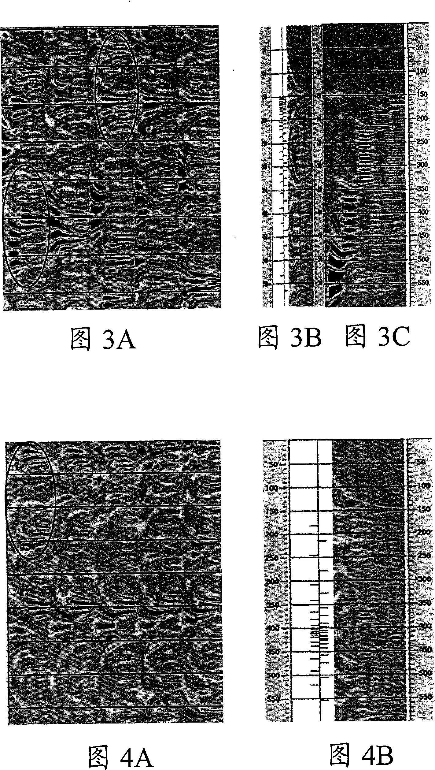 Earthquake gyration analysis method