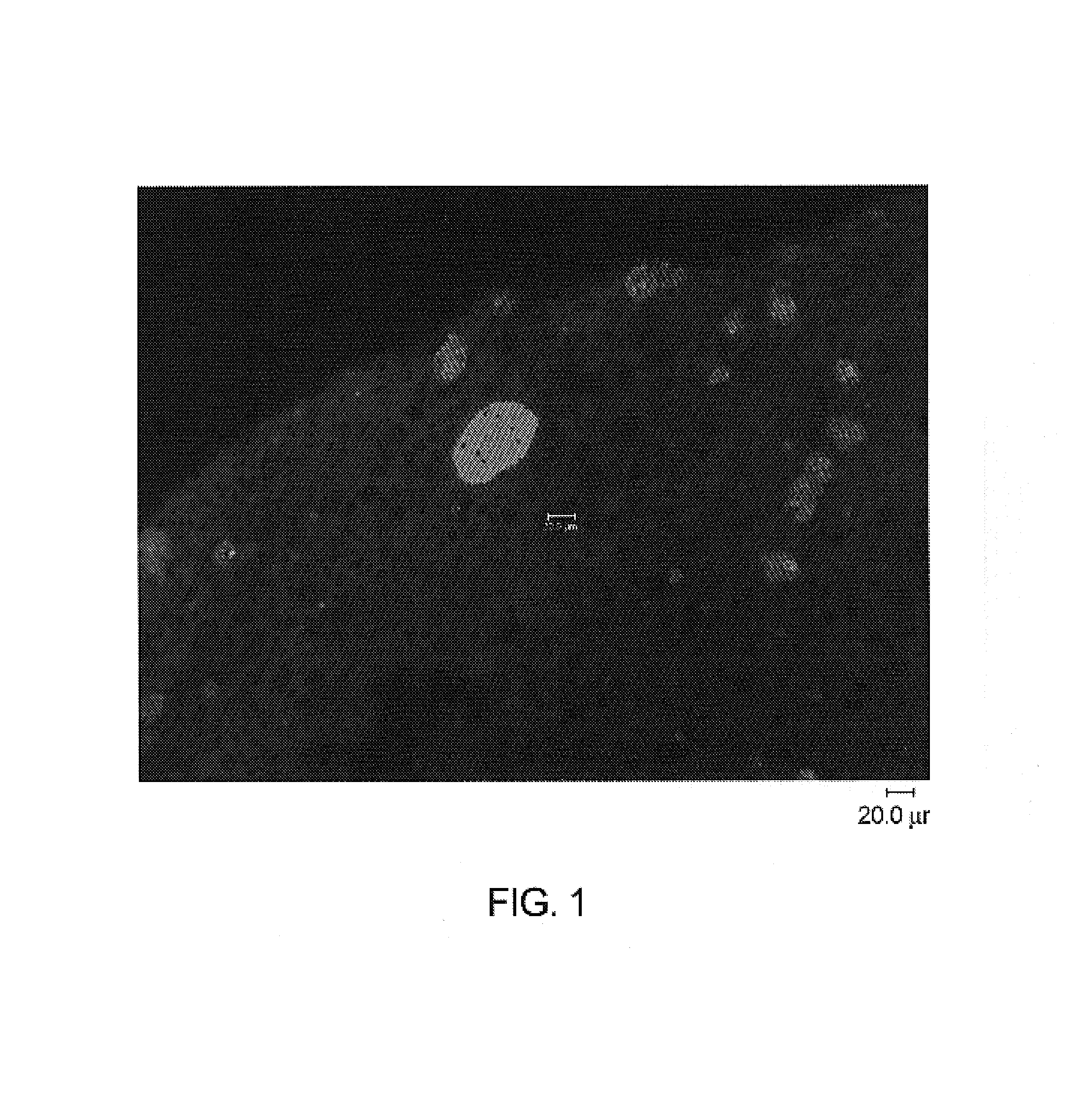 Malarial animal model having a chimeric human liver