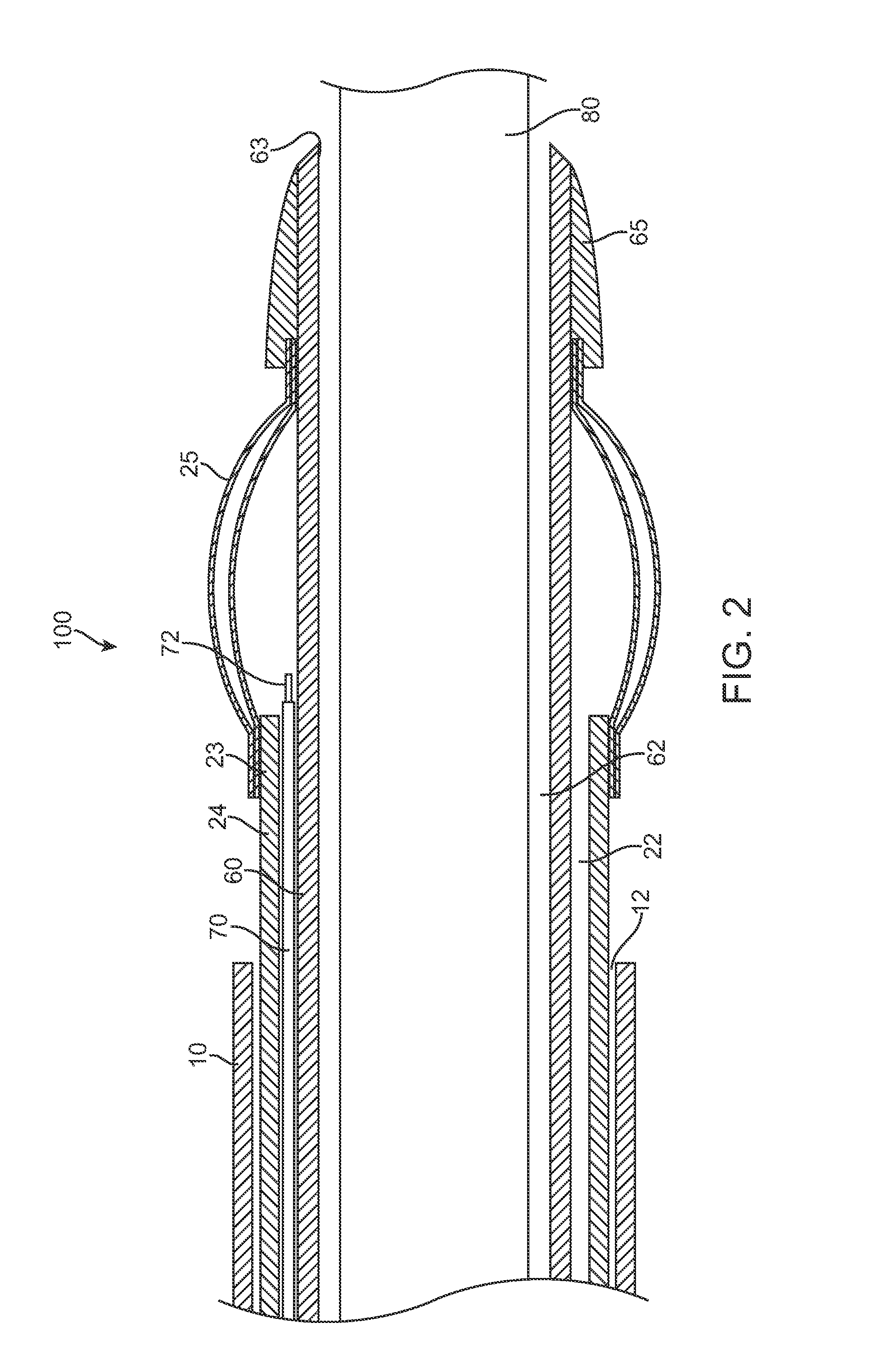 Apparatus and methods for retracting a catheter balloon