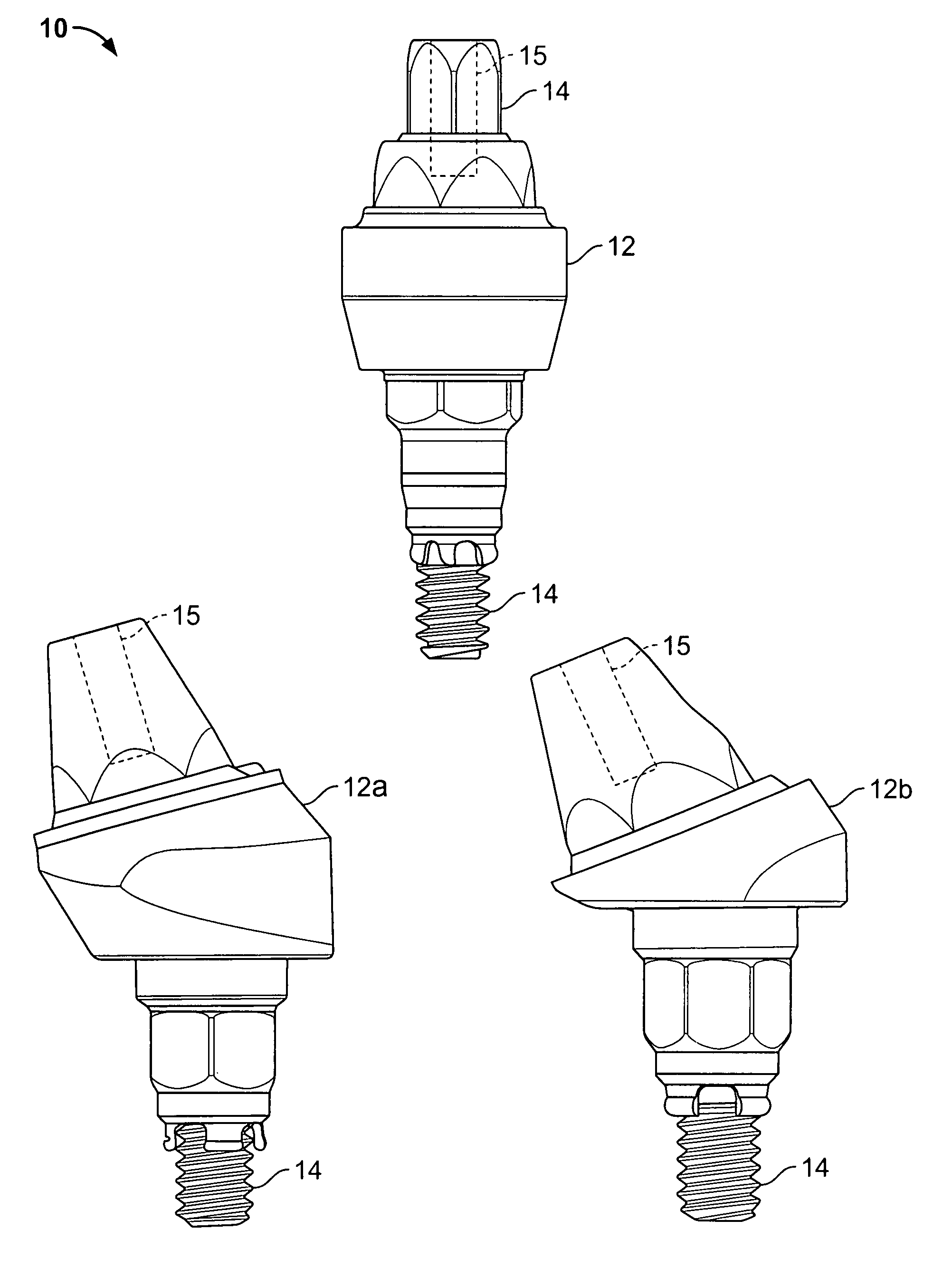 Method for forming a dental prosthesis