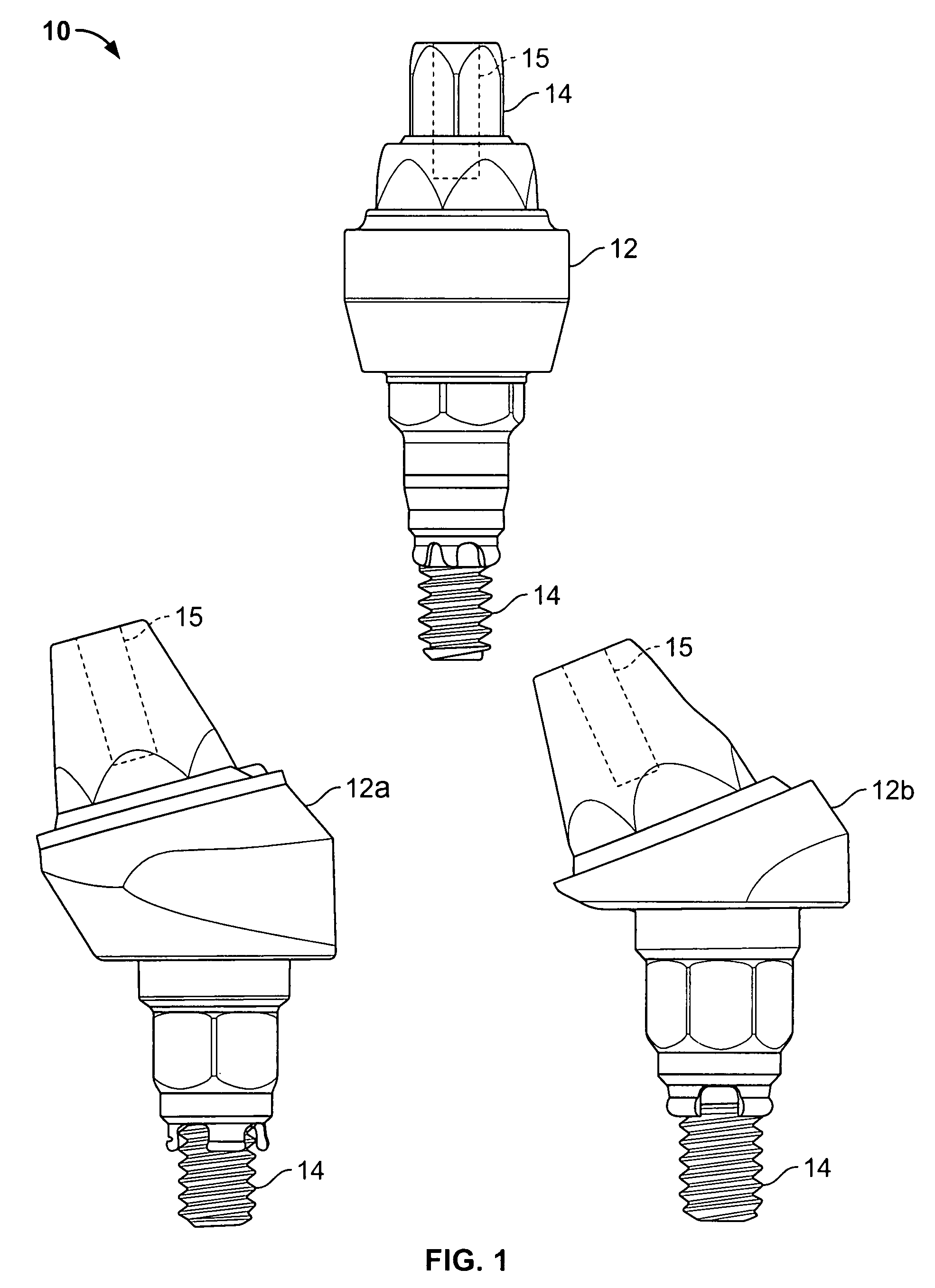 Method for forming a dental prosthesis