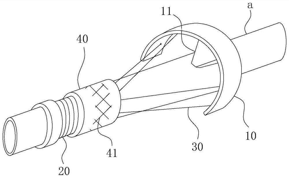 Stomach tube fixator for nasal cavity