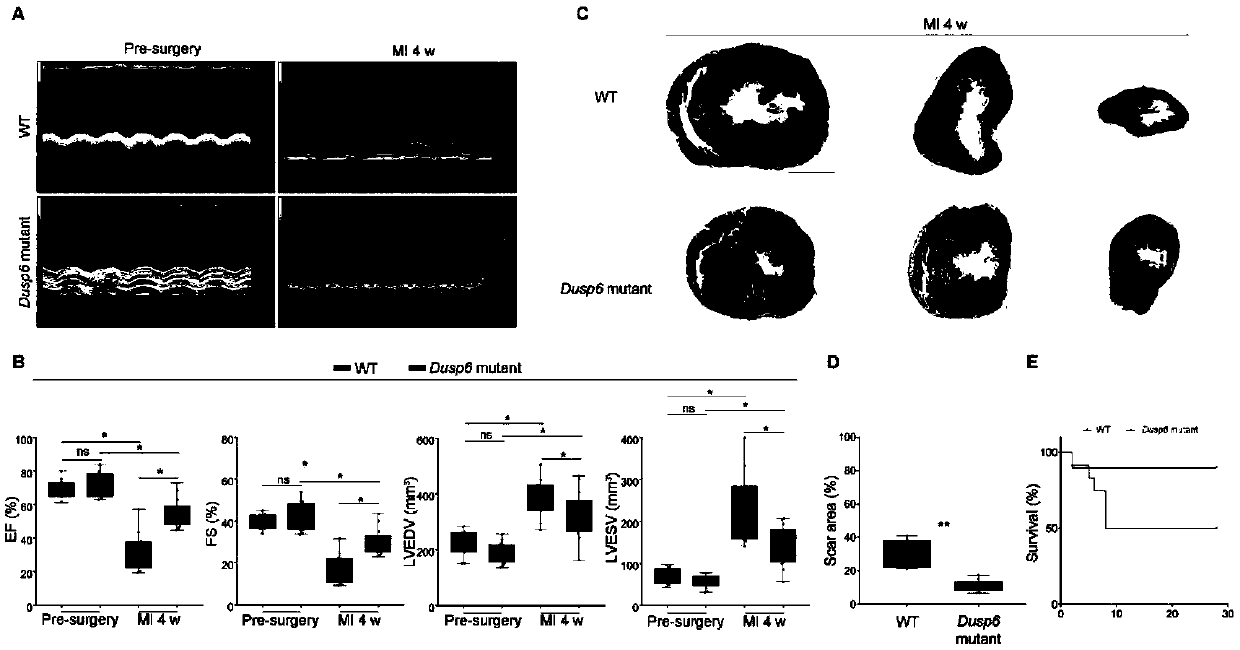 Target DUSP6 related to myocardial infarction diagnosis and treatment and application thereof