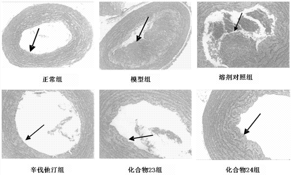 Beta-elemene 14-site ramification and application of beta-elemene 14-site ramification in treating atherosclerosis