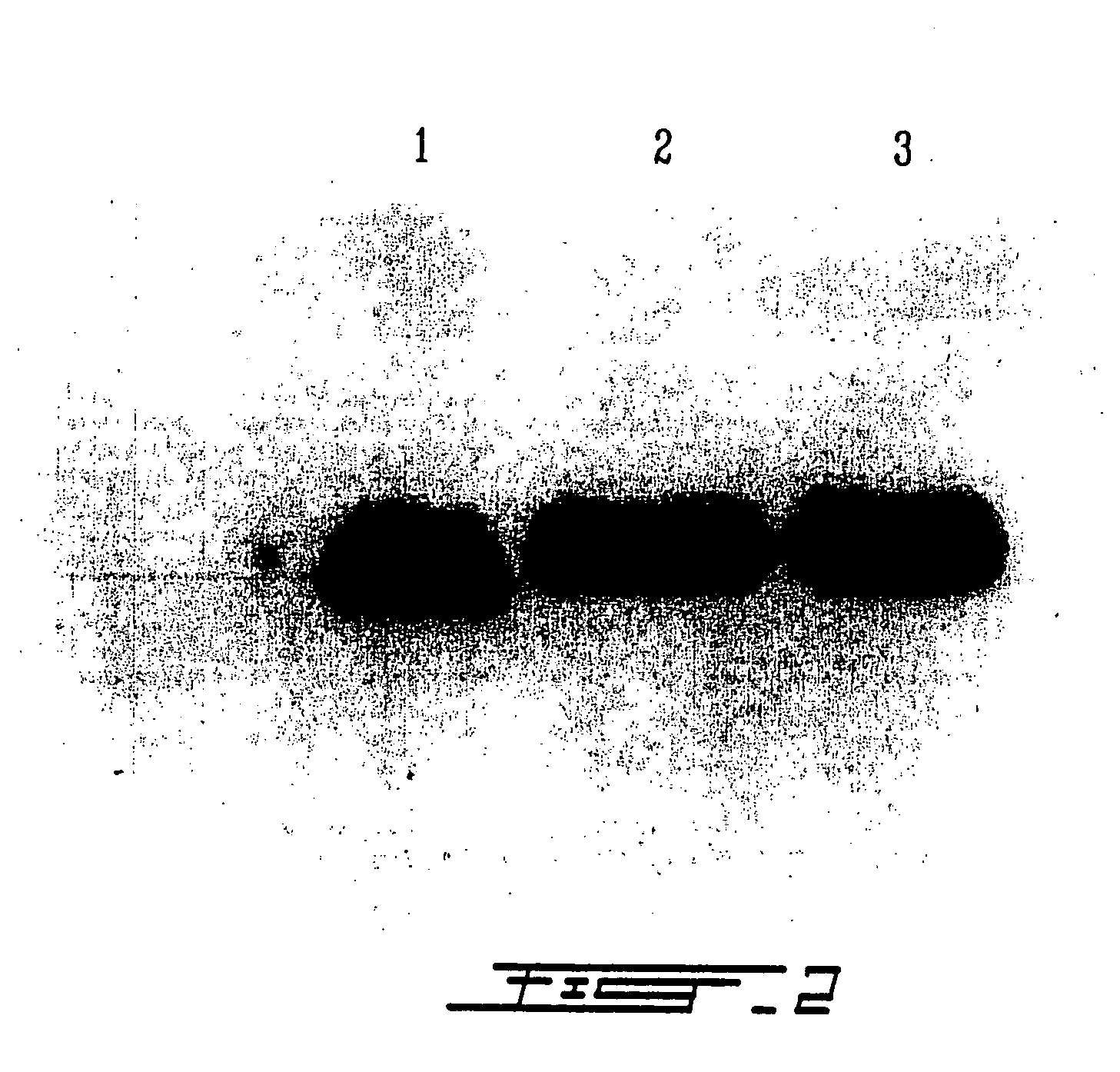 Treatment of macular degeneration with ADP-ribosyl transferase fusion protein therapeutic compositions