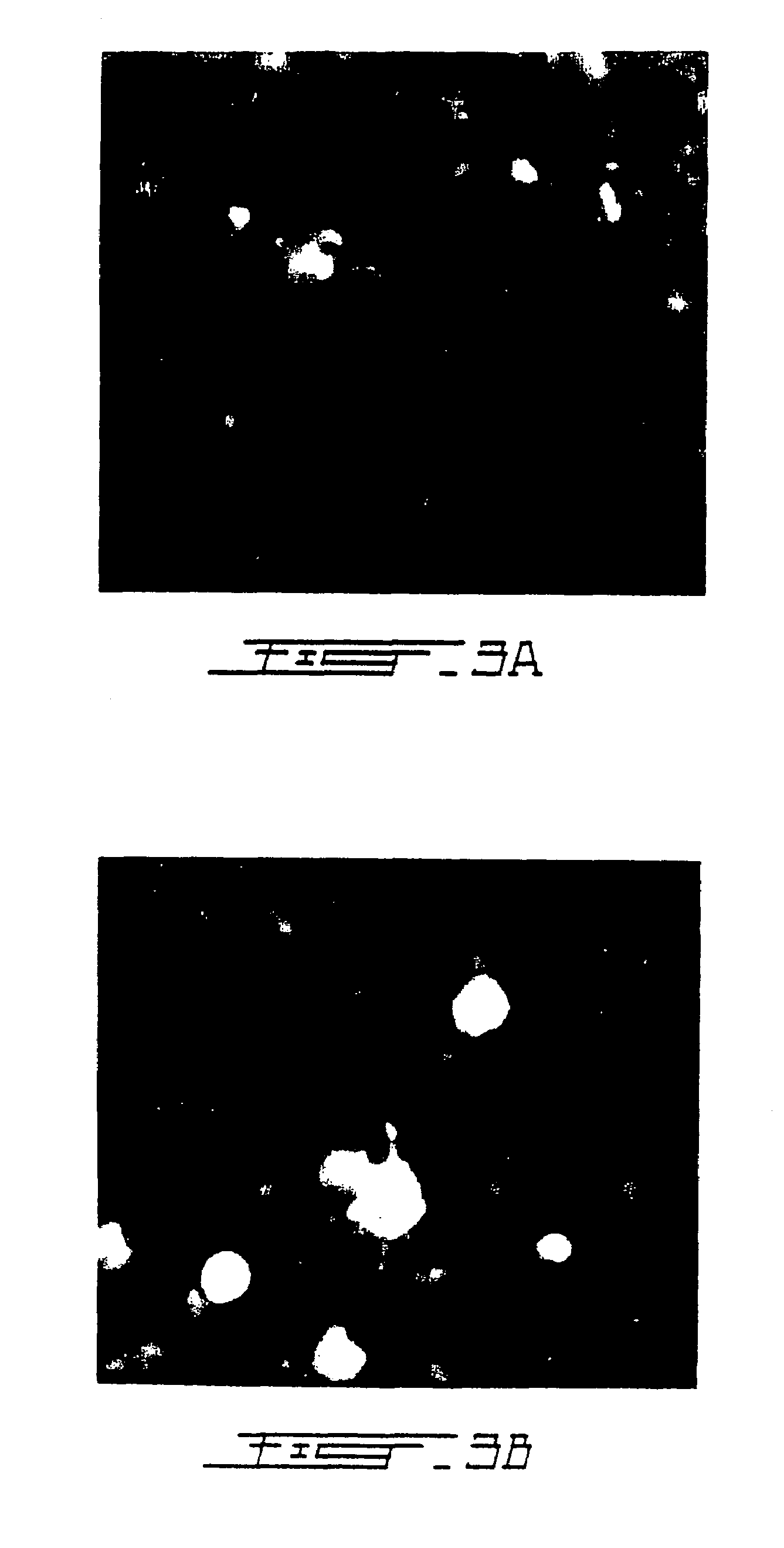 Treatment of macular degeneration with ADP-ribosyl transferase fusion protein therapeutic compositions