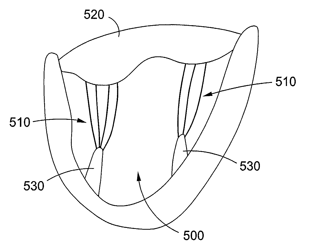 Dynamically adjustable suture and chordae tendinae