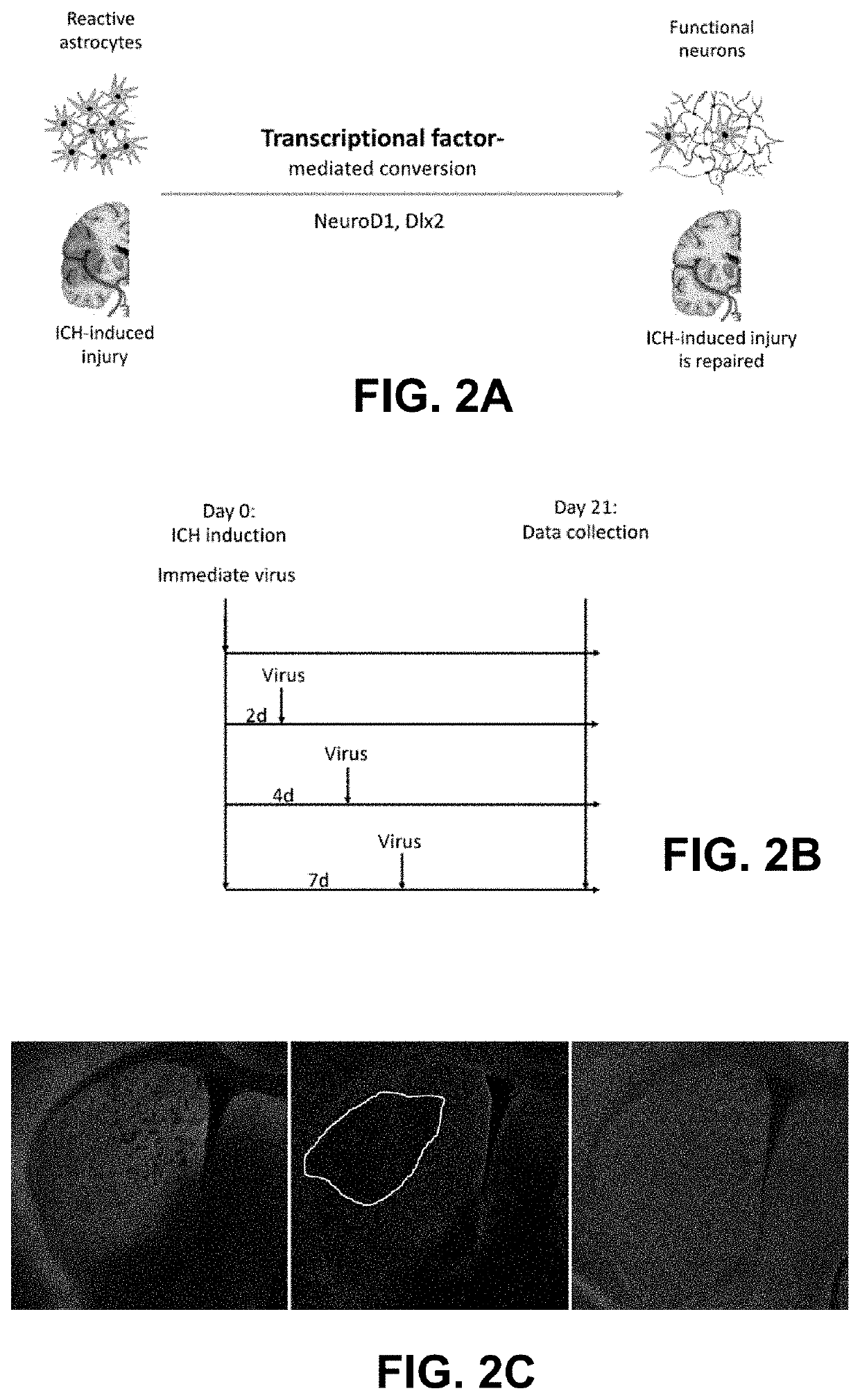 Regenerating functional neurons for treatment of hemorrhagic stroke