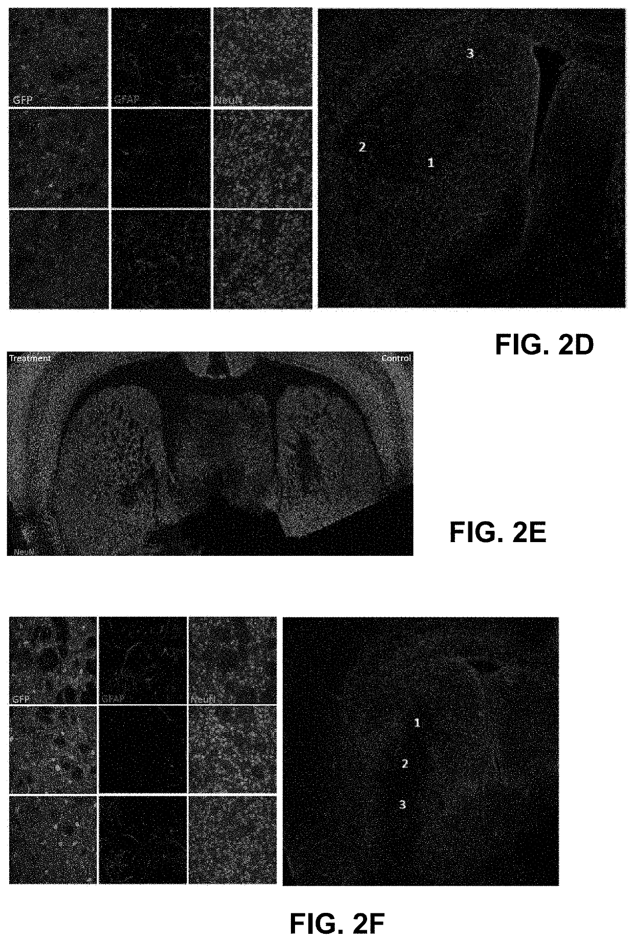 Regenerating functional neurons for treatment of hemorrhagic stroke