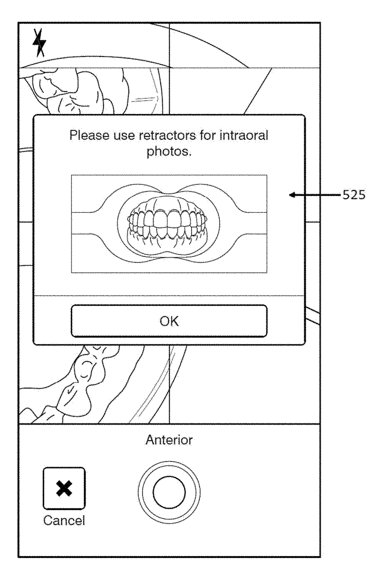 Methods and apparatuses for dental images