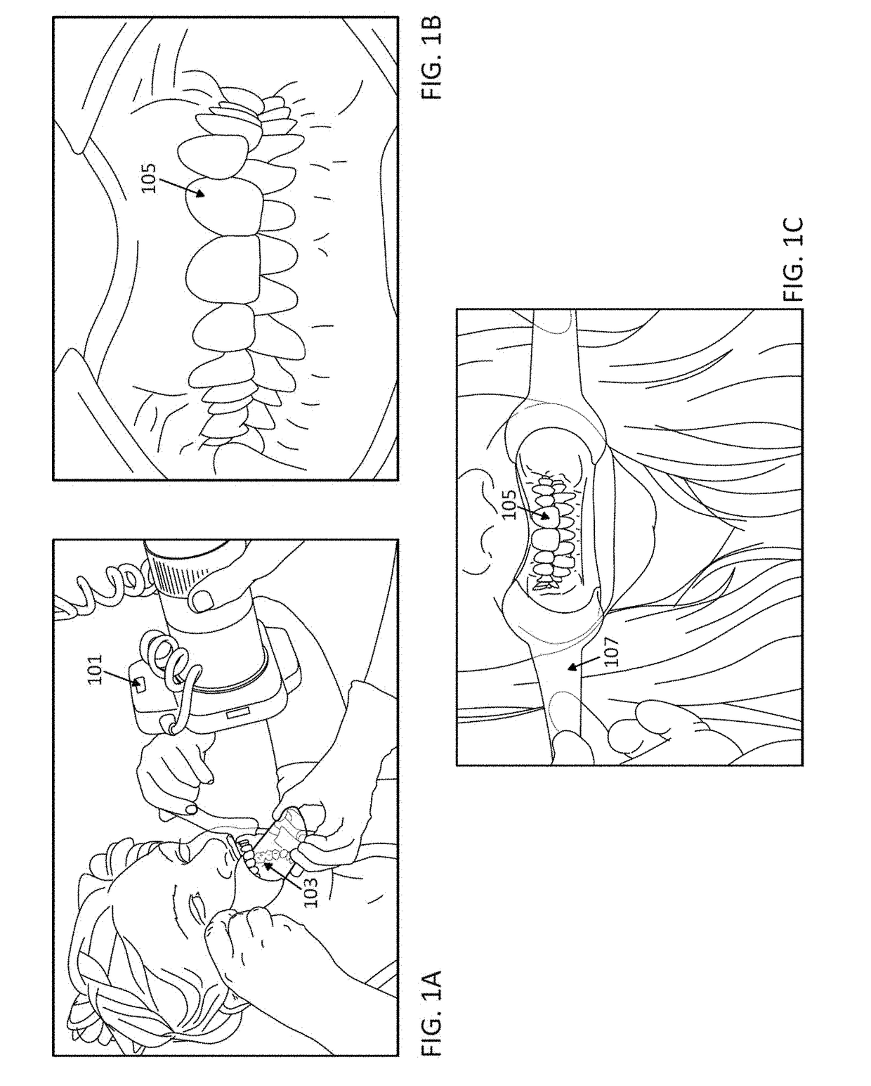 Methods and apparatuses for dental images